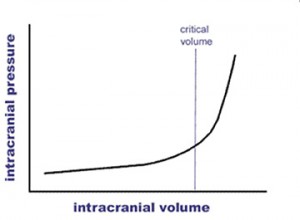 graph-1-ICP
