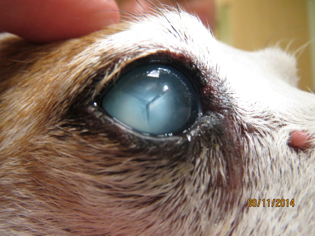 Diabetic cataract with water clefting along Y-sutures dog cataract Shelby Reinstein 