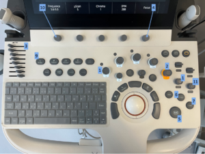 Un'immagine della tastiera a ultrasuoni con tutte le manopole e i pulsanti etichettati con un numero che corrisponde al blog.