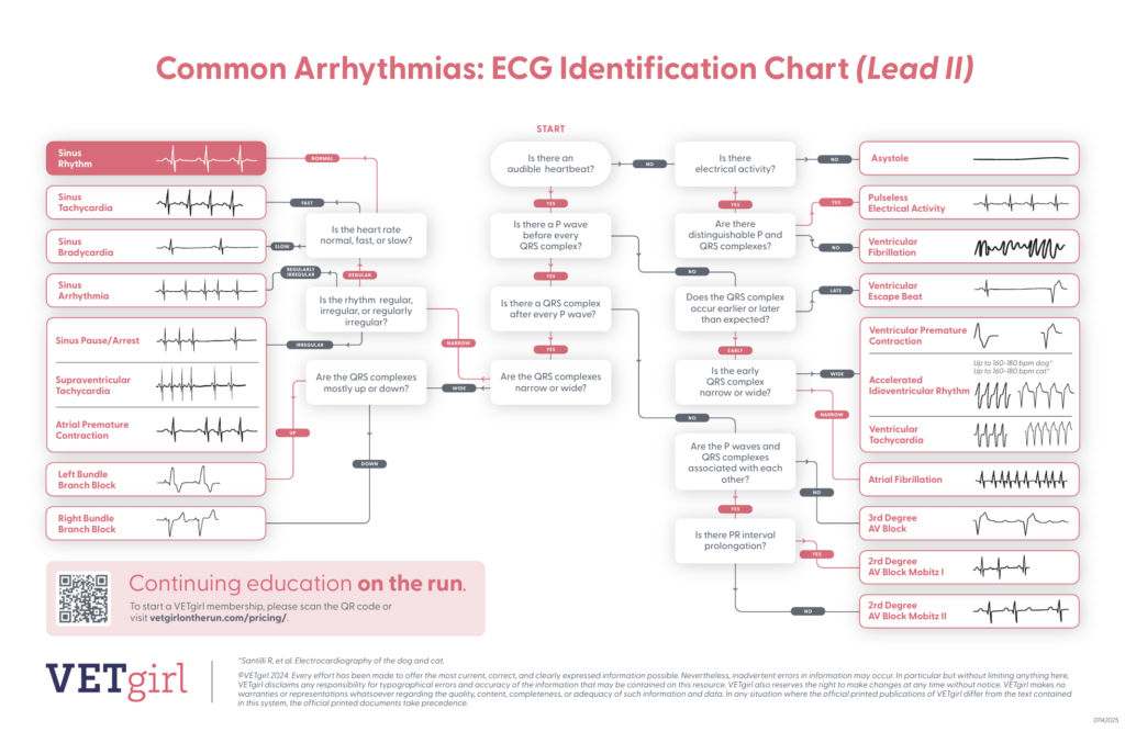 Common Arrhythmias ECG Identification Chart screenshot